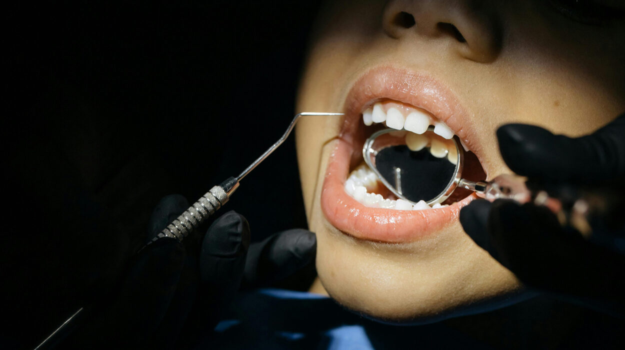 Frein de langue serré et croissance faciale - Calepin Parentalité